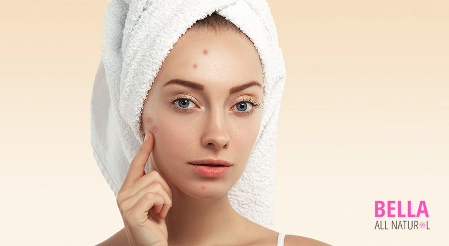 Can Taking Collagen Products Help with Acne Breakouts?