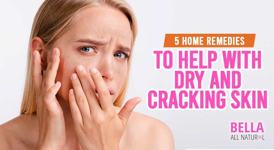5 Home Remedies to Help With Dry and Cracking Skin